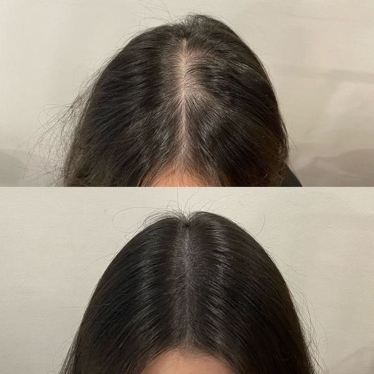 ماسک مو پنتن سری پرو وی (Pro-V) مدل Replacement - ضد ریزش (۳۵۰ میلیلیتر)